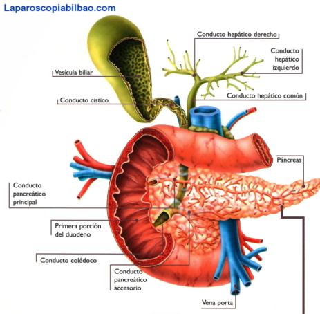 Coledocolitiasis - LaparoscopiaBilbao